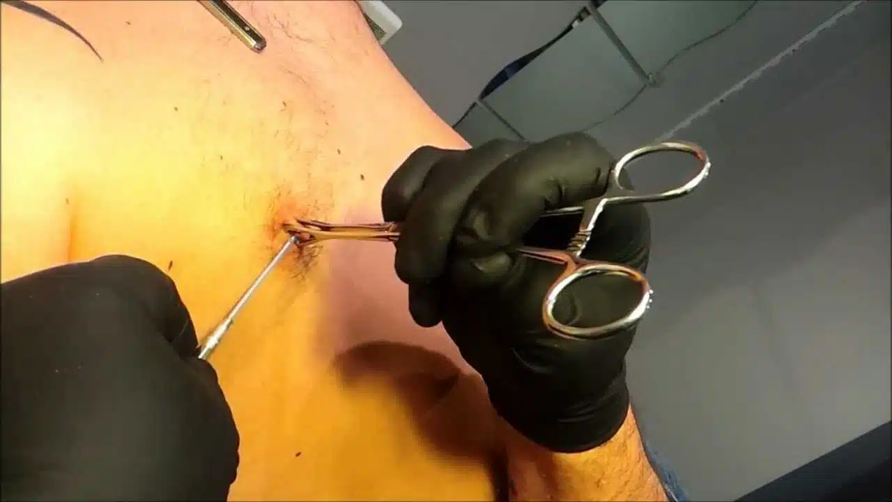 Piercing au téton tout ce qu'il faut savoir avant de se lancer